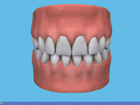 2866997